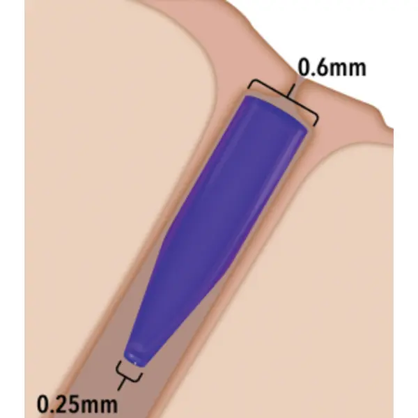 Punctum plug, Soft ED 180-T 40pk ONE SIZE 6210