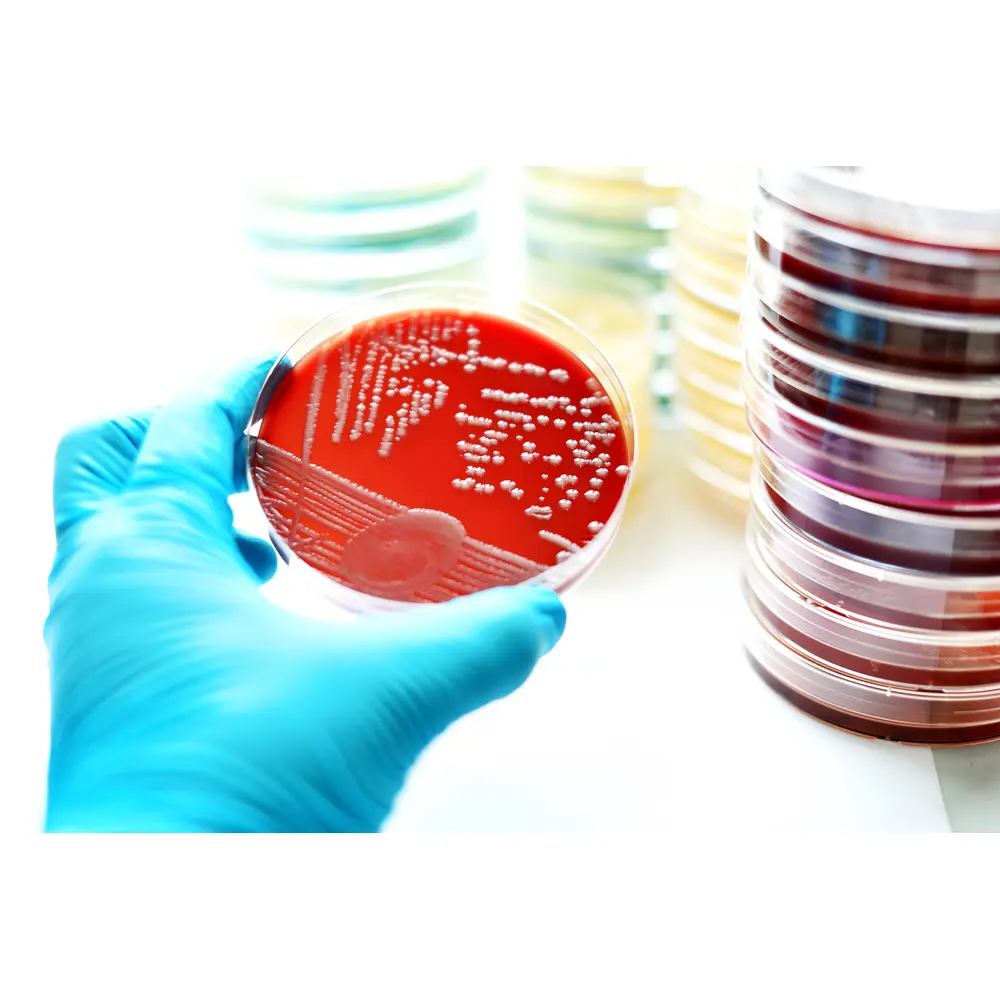Prepared Plated and Tube Culture Media